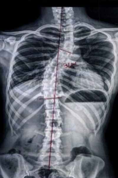 곽0은_after-spine-reset