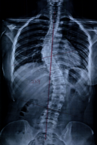 곽0은_before-spine-reset