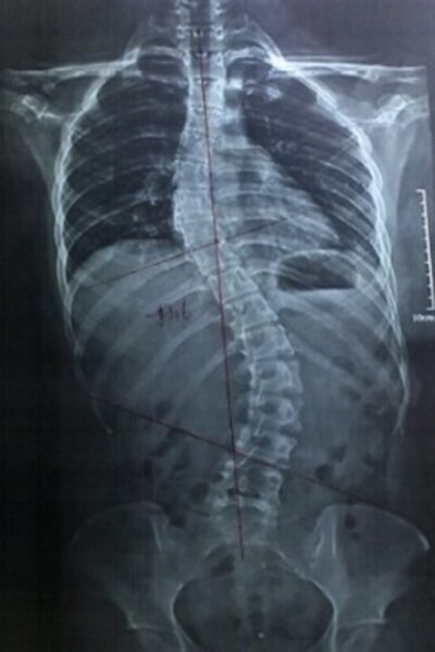 김0진_before-spine-reset