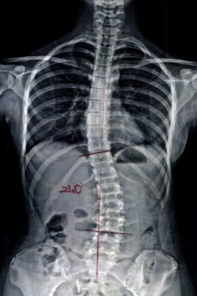 신0진_after-spine-reset