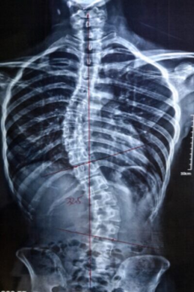 이0영_after-spine-reset