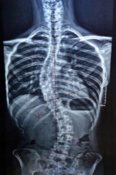 이0영_before-spine-reset